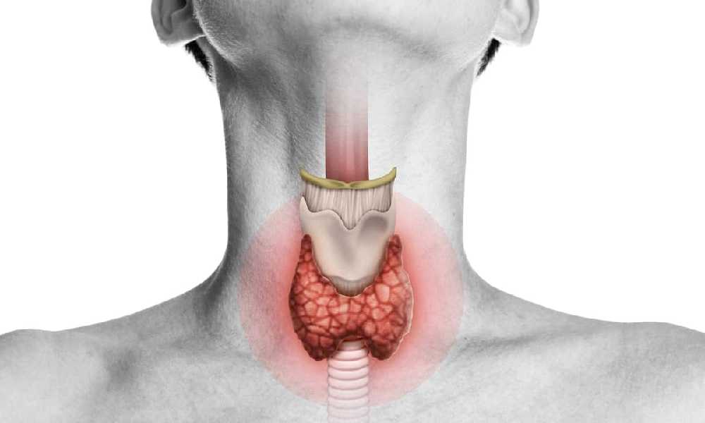 Hyperthyroidism (Overactive Thyroid): Symptoms, Causes, and Treatment